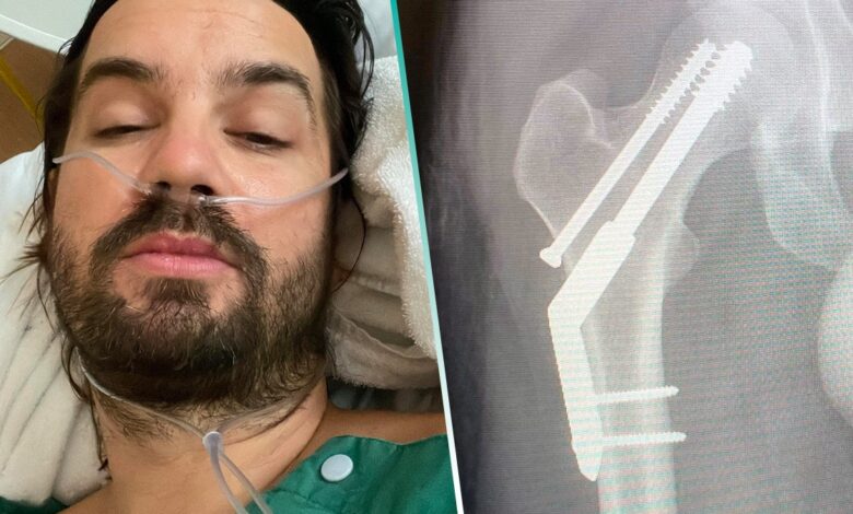 Kevin Parker se fracturó la cadera