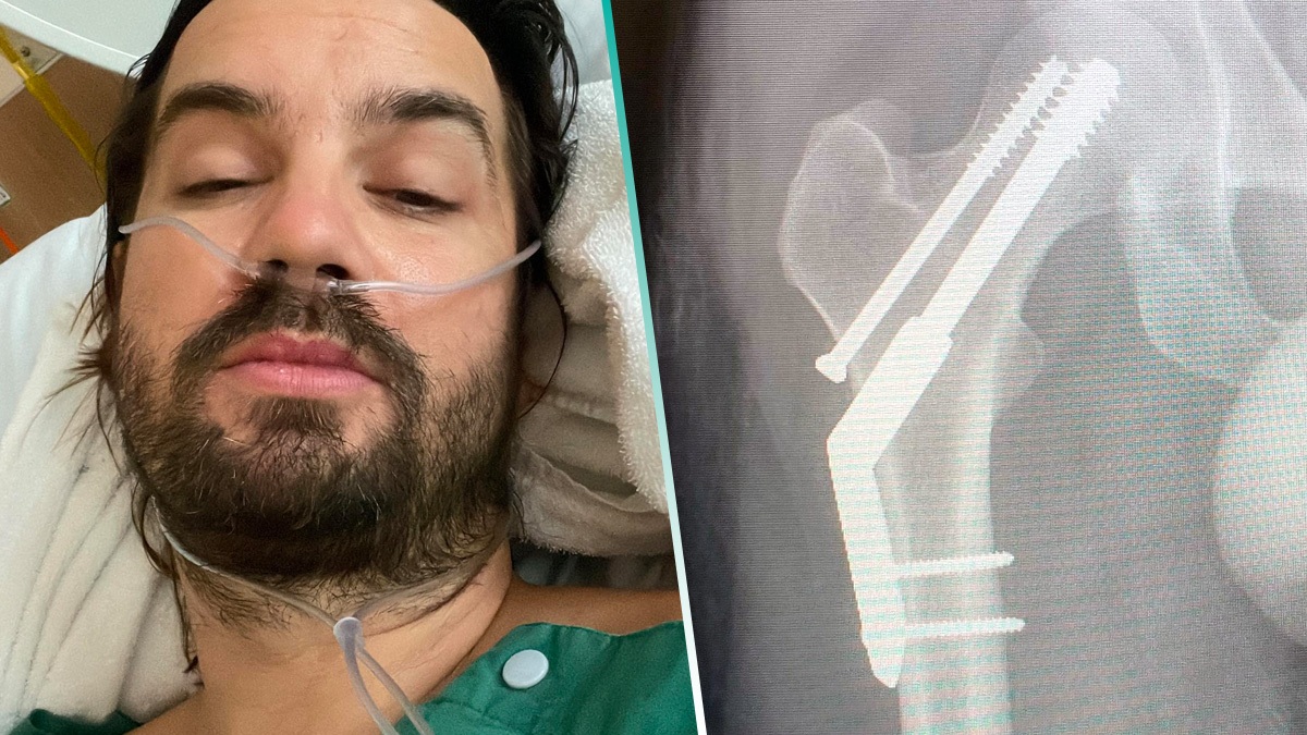 Kevin Parker se fracturó la cadera