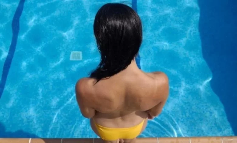 Berlín topless