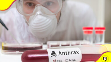 Ántrax virus OMS síntomas