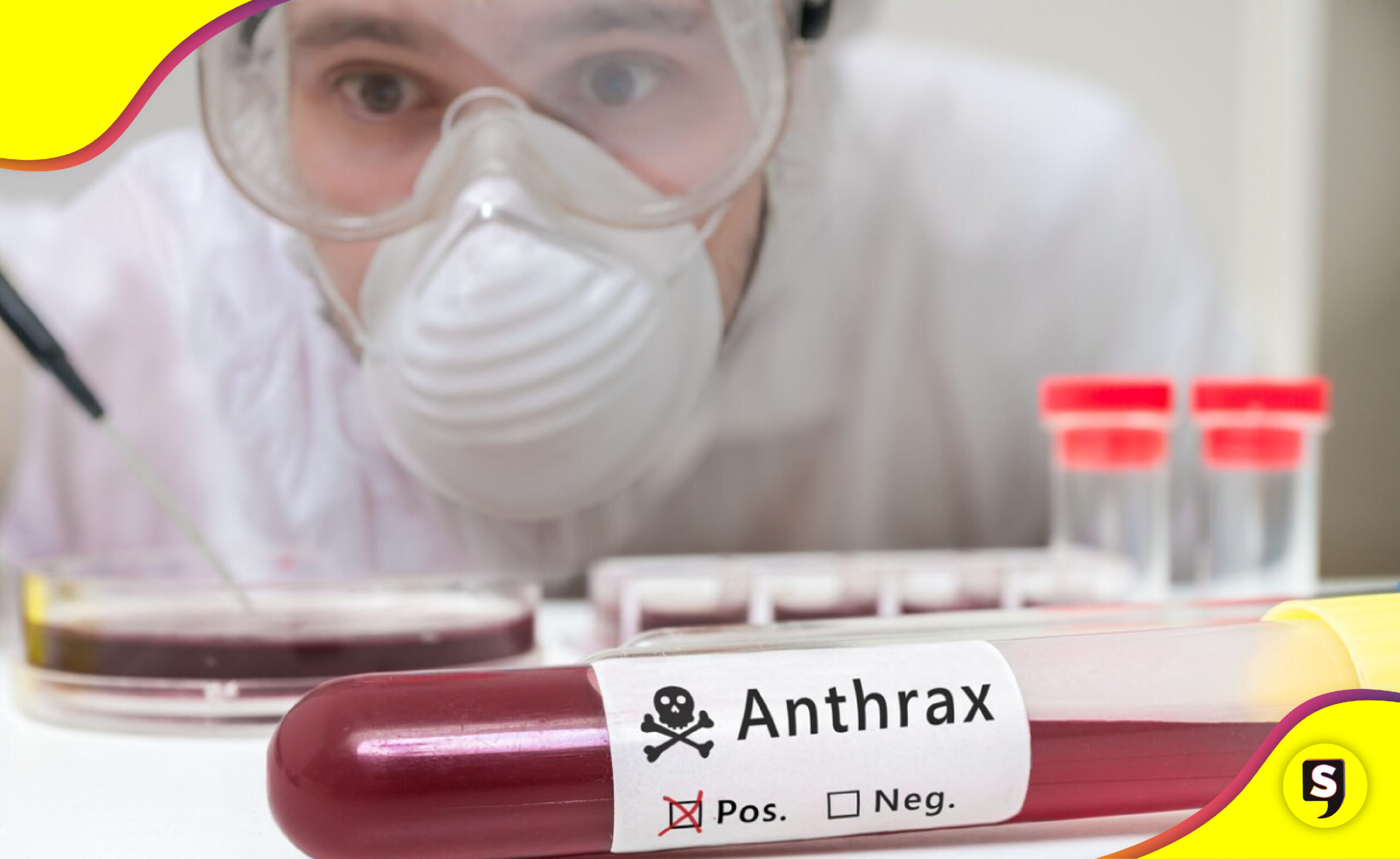 Ántrax virus OMS síntomas