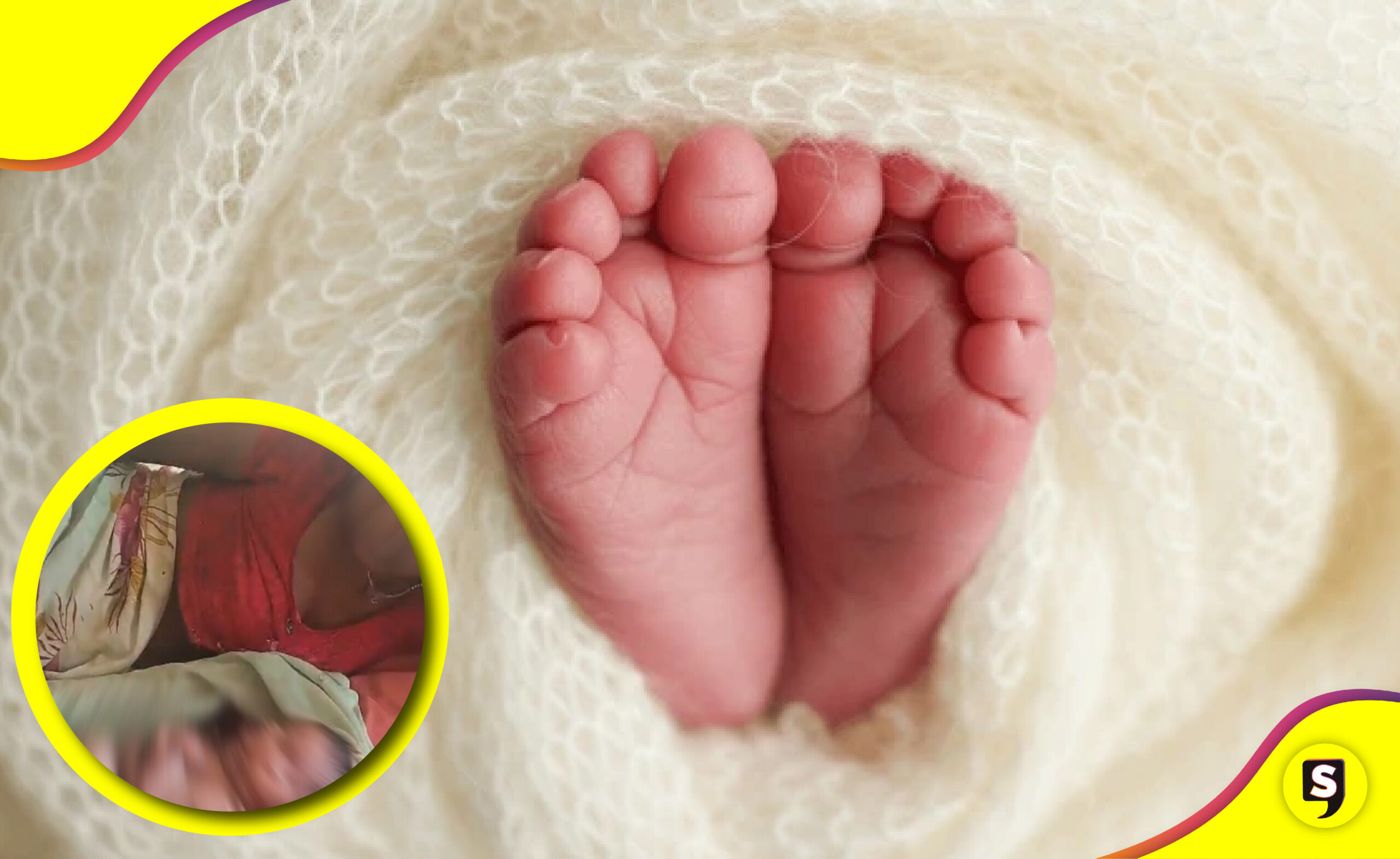bebé 4 piernas en India