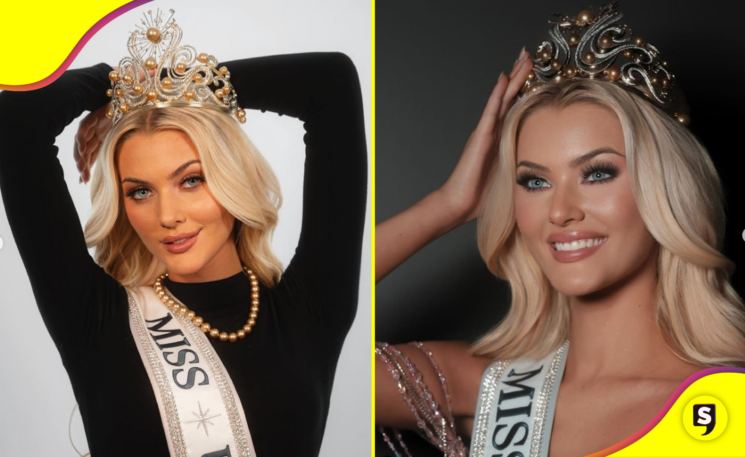Miss Universo 2024 sin maquillaje