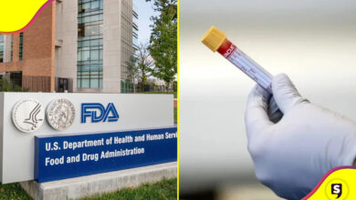 FDA test Alzheimer