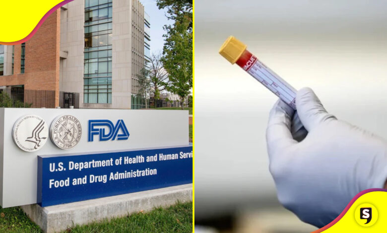 FDA test Alzheimer