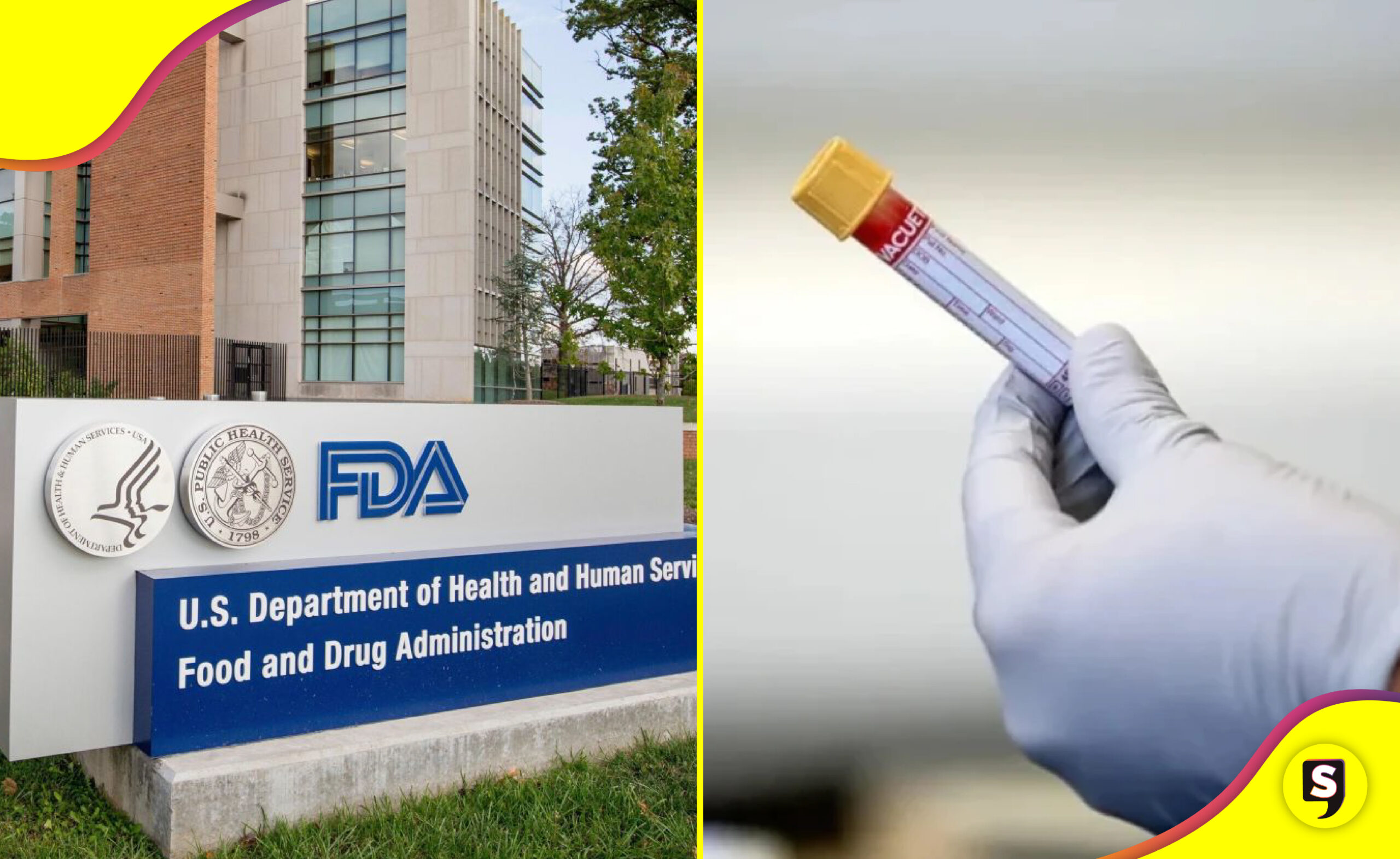 FDA test Alzheimer