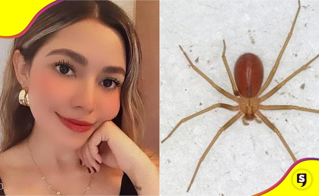 araña violinista negligencia del IMSS