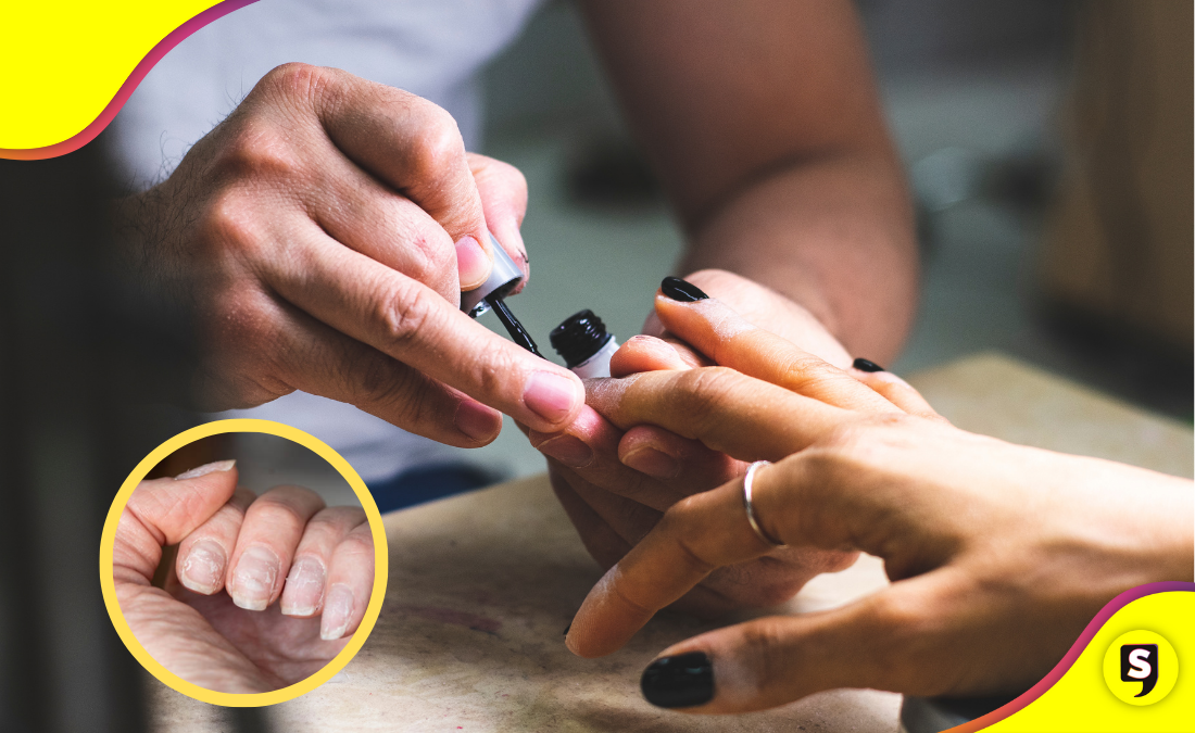 ¿Uñas quebradizas? Aquí la solución avalada por expertos.