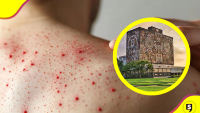 UNAM reporta caso sospechoso de sarampión en un alumno