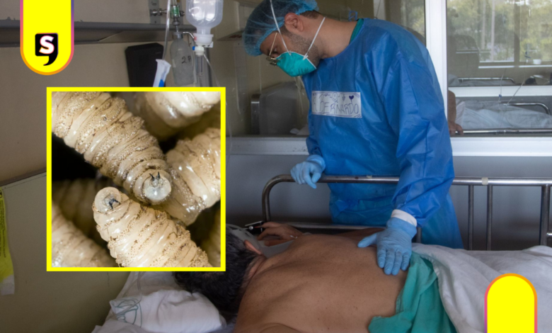 Gusano barrenador humano llega a la CDMX